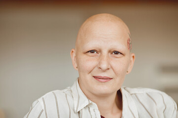 Fototapeta premium Minimal head and shoulders portrait of bald adult woman looking at camera and smiling while sitting on couch in warm-toned interior, alopecia and cancer awareness, copy space