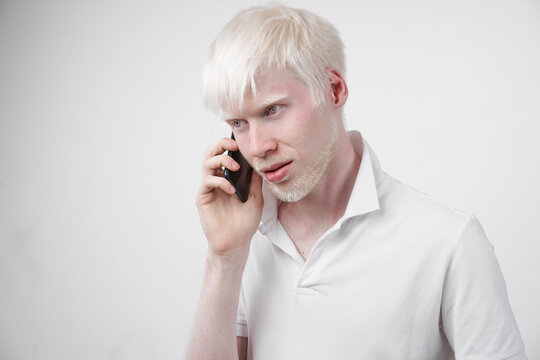 albinism albino man in studio dressed t-shirt isolated on a white background. abnormal deviations. unusual appearance