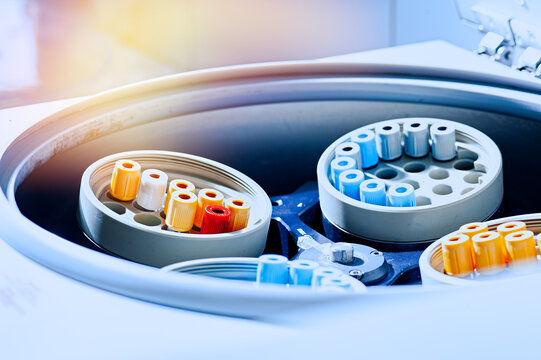 laboratory centrifuge with test tubes with biomaterial