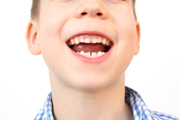 boy, kid smiling with open mouth, close up of child’s mouth, teeth, concept of child skin care, emotional development of elementary school students, dentistry