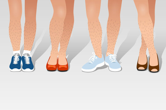 Various Unshaved Hairy Woman's Legs With Different Shoes On Feet