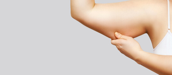Young woman pinch fat arm. Hand pinching body. Female person showing overweight triceps. Positive...