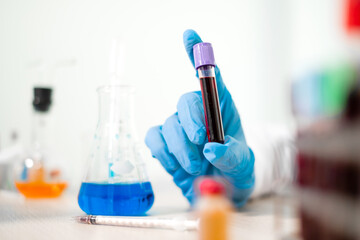 Professional doctors perform find virus tests from samples of blood tests to diagnose coronary virus infections analysis and sampling of infectious