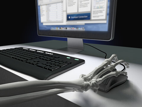 Carpal Tunnel Syndrome,Skeletons and computer, Arms bones on Office working table, Concept for chiro