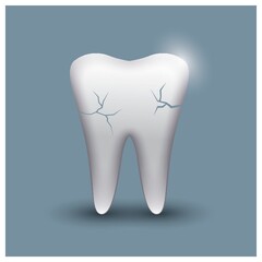 cracked tooth