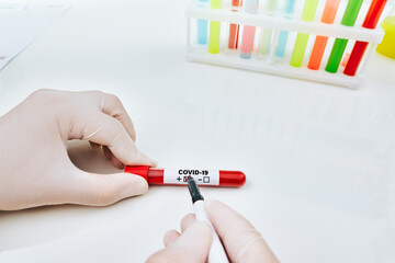 Blood sample test tube with positive result in doctor hands