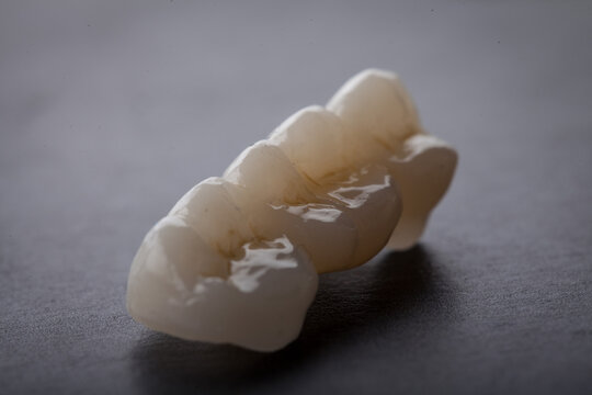 Dental Art, Smile design, Teeht