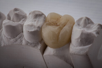 Dental Art, Smile design, Teeht