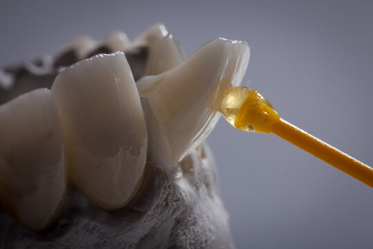 Dental Art, Smile design, Teeht