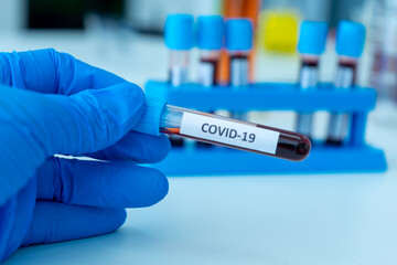 Fototapeta premium blood sample in test tube galssware in science laboratory equipment to diagnosis for virus pandemic