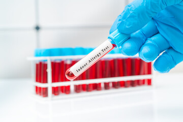 Blood sample   test tube in doctor hand for  allergies pet dander, mold