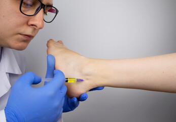 An orthopedic surgeon injects medicine into the Achilles tendon to relieve pain. Help treat...