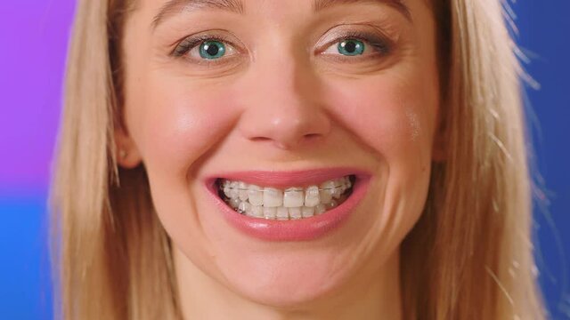 Caucasian woman with blue eyes and braces on her teeth smiles and looks at the camera.