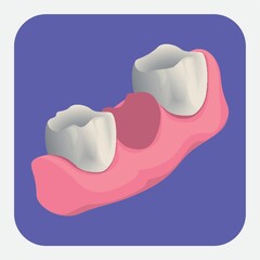 extracted tooth