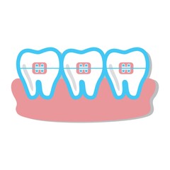 teeth with braces