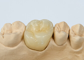 Zirkon Krone auf dem Model Palatinate Ansicht