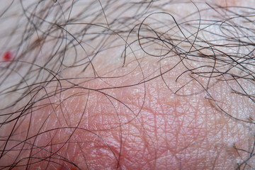 Part of the skin of a man with hair near the areola of the nipple with a strong increase. Concept - human skin and care for it.