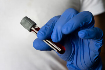 Blood tube in the hand of doctor or nurse
