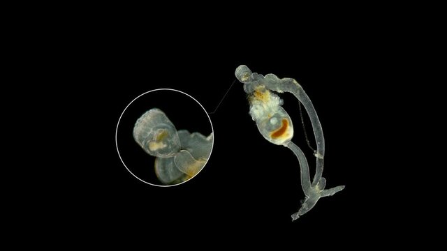 Entoprocta (Kamptozoa) under the microscope, living in the sea either singly or in colonies, were formerly considered a subclass of bryozoans. Little explored species. Sample found in the Barents Sea