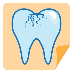 cracked tooth