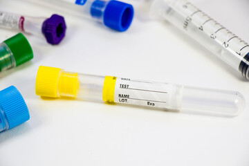 Blood test empty tubes samples on the white background, studio shoot.