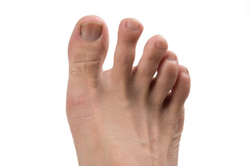 Man foot on a white background