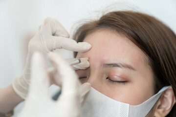 Hands of beautician injecting botulinum in female forehead. Woman closed her eyes and wearing face mask.