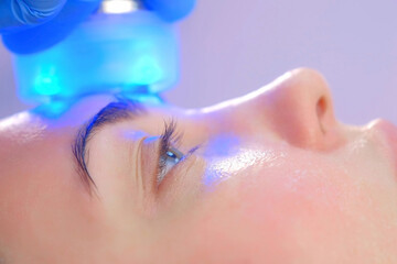 Fototapeta premium Portrait of woman on apparatus hardware phonophoresis face procedure with hyaluronic acid gel in cosmetology clinic, closeup side view. Cosmetologist doctor moving manipula with cooling blue light.