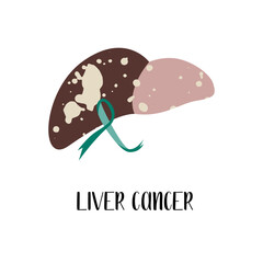 Liver cancer, carcinoma. Emerald awareness ribbon. Vector flat illustration, isolated on white