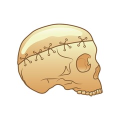 skull