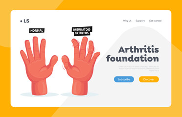 Normal and Sick Hands with Rheumatoid Arthritis Landing Page Template. Finger Joints Inflammation Healthcare, Treatment