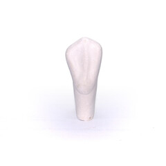 Plaster model of a tooth