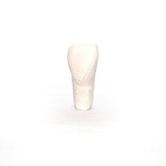 Plaster model of tooth