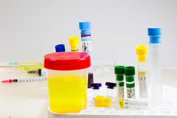 Drug test, medical urine and pee test with blood and other tubes on the white background, colorful...
