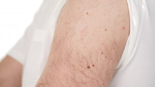 Close-up of unrecognizable man's hand ripping medical plaster from his shoulder. Demonstration of injection mark. Vaccination. Health care concept.
