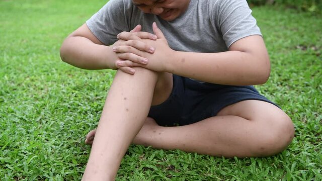 Obese boy having knee pain and massage knee
