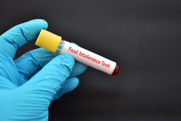 Obraz premium Test tube with blood sample for food intolerance test