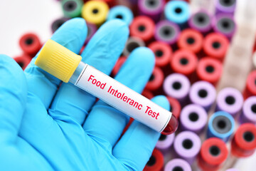 Test tube with blood sample for food intolerance test