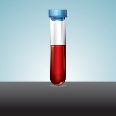 blood and plasma in test tube
