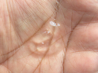 Transparent dollop of Hand sanitizer liquid on palm of hand