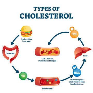 Types of cholesterol educational cycle scheme from fatty food to LDL artery