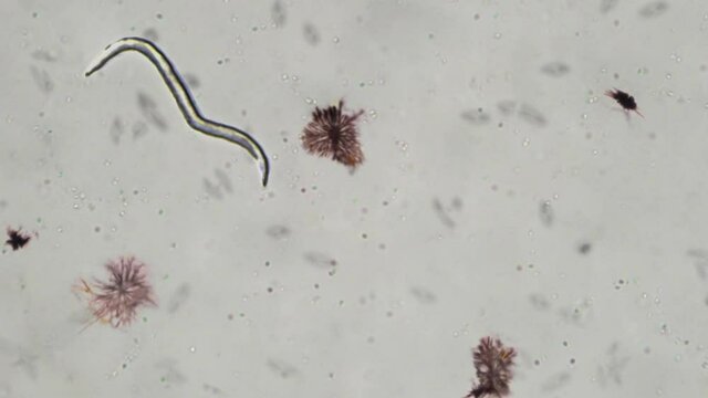 Parasitic Worm and Other Microbes