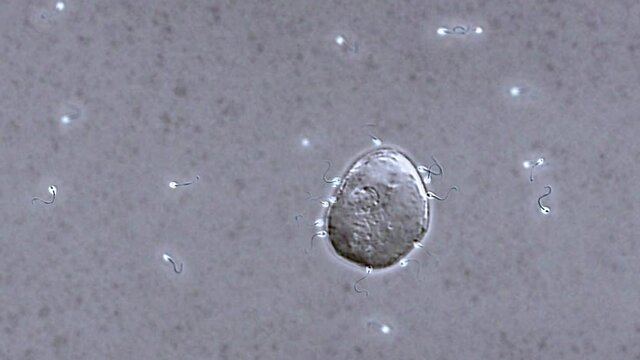 Sperm Cells Fertilizing Egg
