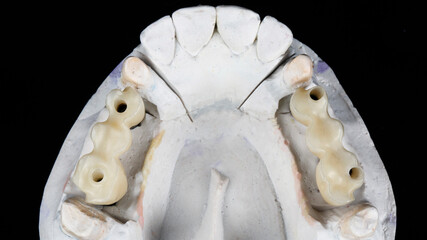 bases for dental crowns of chewing bridges, top view on a black background