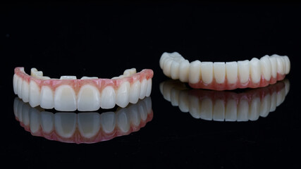 temporary dentures for the patient's upper and lower jaw after dental implantation