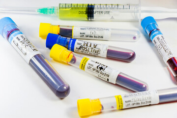 H1N1, Covid-19, Hepatitis C, Tuberculosis and Staphylococcus viruses blood tests in the tubes, laboratory diagnostics