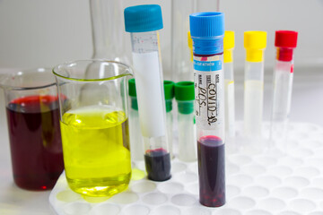 Corona virus, NCOV and Covid - 19 positive test samples. Blood tube samples. Diagnoses and laboratory research. Chemical elements.