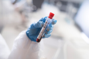 A scientist examining a blood sample in a test tube with a sticker displaying a coronavirus negative sample.