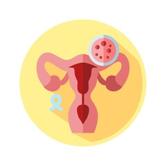 Cervical Cancer Info Graphic Element Flat Icon Illustration