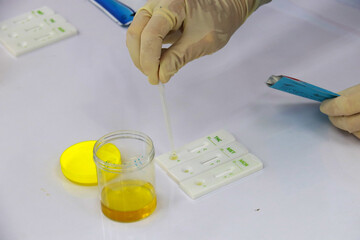 Substance Abuse Detection by examining the urine, Urine analysis for screening amphetamine, Methamphetamine cassette for search the substance Abuse